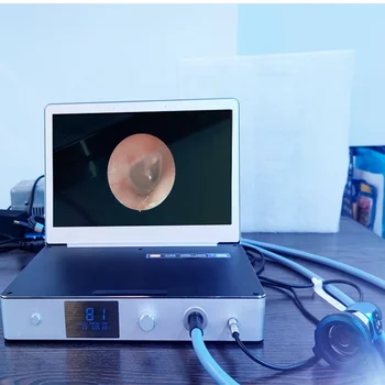  LED ışık kaynağı ile ucuz tıbbi taşınabilir endoskop kamera sistemi USB